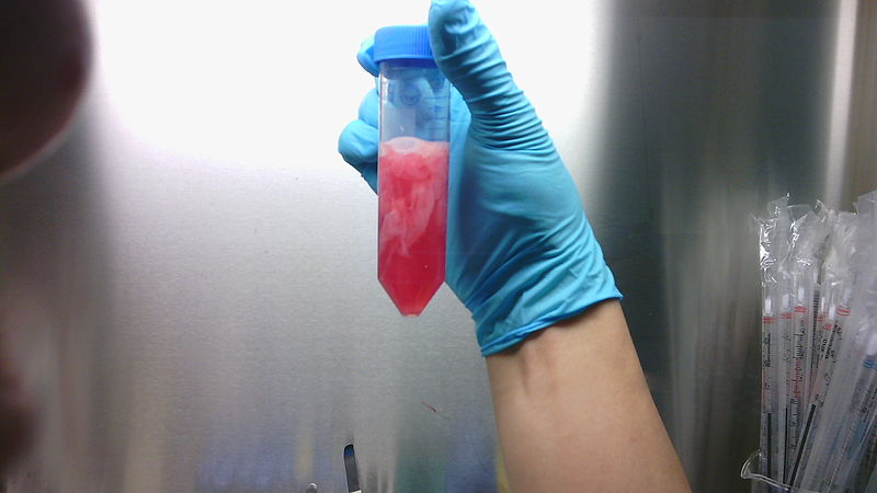 Tubo que contiene una donación de placenta, proveniente de una mujer voluntaria para el desarrollo de una investigación. Foto: Aidar Seralin/CC BY-SA 4.0, via Wikimedia Commons.
