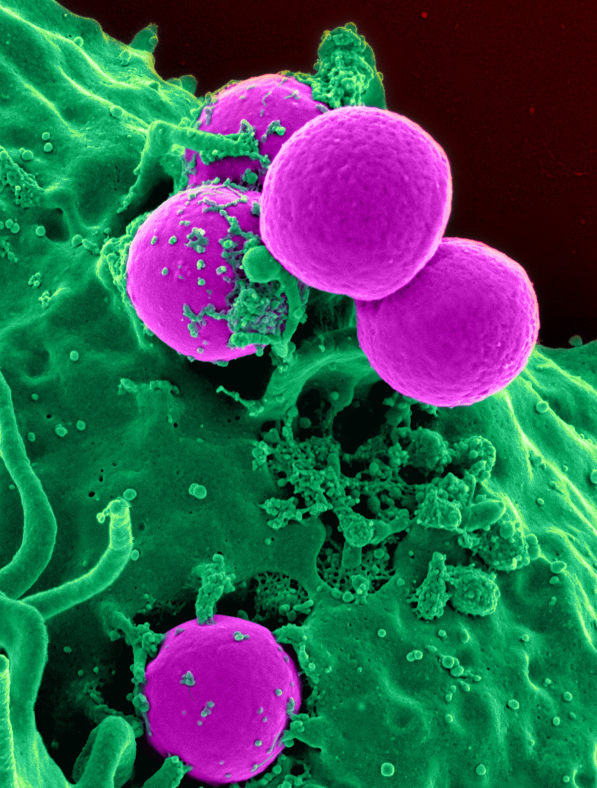 El revolucionario sitema israelí consigue rodear las moléculas de ARN con nanopartículas lipídicas que envían el tratamiento directamente a las células cancerosas. Foto: Pixabay/Pexels.