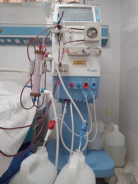 Una máquina de diálisis, utilizada para limpiar los desechos de la sangre de una persona cuyos riñones ya no pueden realizar este trabajo vital. Foto: Yahya/Wikimedia Commons.