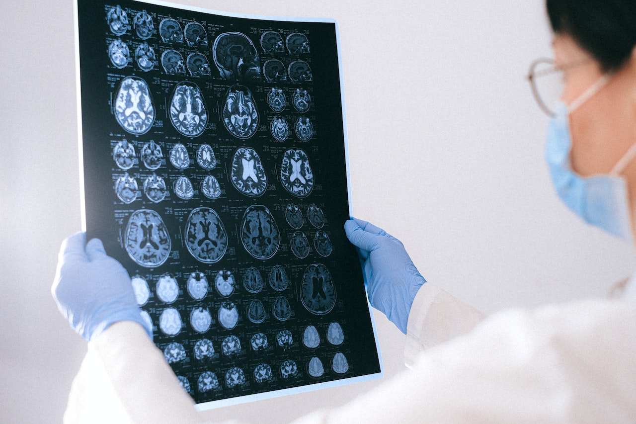 El nuevo estudio israelí consistió en el desarrollo de un medio cuantitativo de medir el hierro en un cerebro vivo utilizando escaneos de MRI. Foto: Anna Shvets/Pexels.