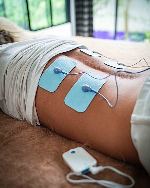 El uso de corrientes eléctricas es muy habitual en el mundo de la medicina, como terapia para el dolor crónico y la recuperación de lesiones. Foto: Ypsitens/CC BY-SA 4.0, via Wikimedia Commons.