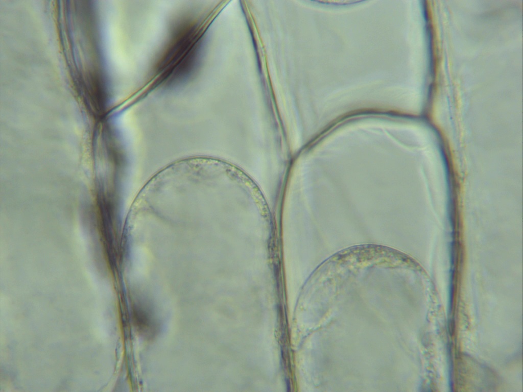Célula vegetal sometida a plasmólisis. Foto: Nicholas.H.Hale, CC BY-SA 4.0, via Wikimedia Commons.