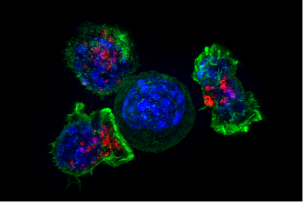 Grupo de células T (verde y rojo) que rodean una célula cancerosa (azul, centro). Foto: The National Institutes of Health, Public domain, via Wikimedia Commons.